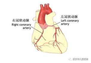 coronary artery imaging 1st om proximal lesion diffuse irregularities,Understanding Coronary Artery Imaging