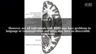 brain damage from pressing om carotid,Understanding the Om Carotid