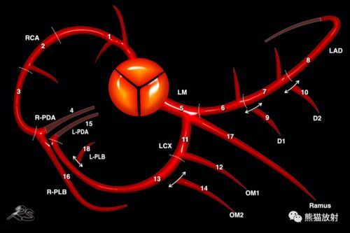 circumflex artery om,Circumflex Artery: An In-Depth Look at Its Anatomy, Function, and Clinical Significance